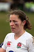 Emma Croker the England rugby hooker with a black eye 2.2.2013, Esher, - D2WGP2